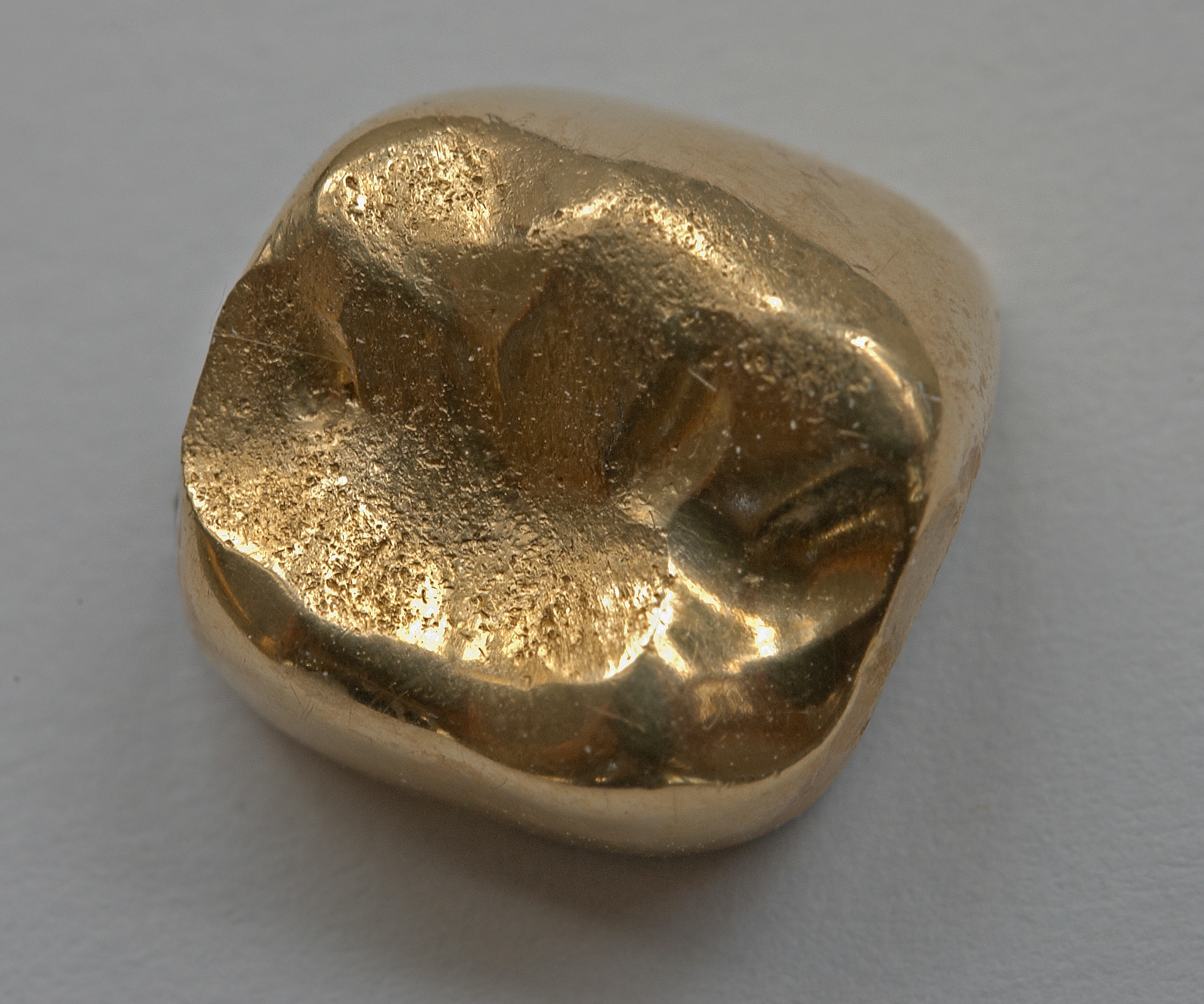 Éléments dentaires contenant de l’or